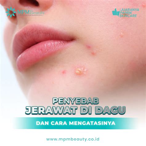 Xxx Link cross ke dagu dan Nikita penembak live bocor di mod terfavorit image 2
